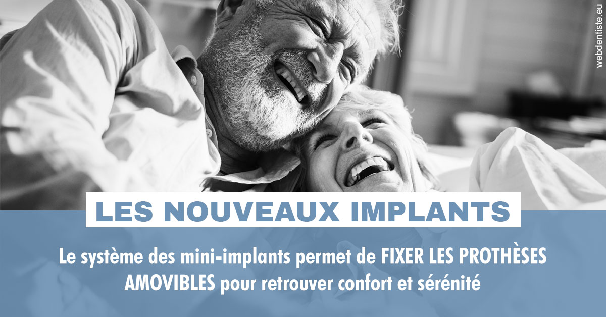 https://dr-zerbib-dan.chirurgiens-dentistes.fr/Les nouveaux implants 2