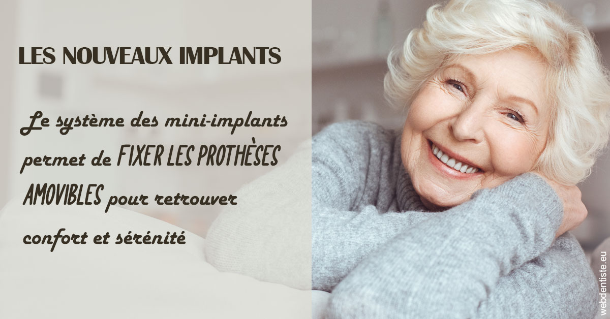 https://dr-zerbib-dan.chirurgiens-dentistes.fr/Les nouveaux implants 1