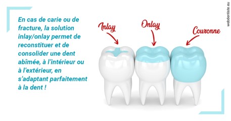 https://dr-zerbib-dan.chirurgiens-dentistes.fr/L'INLAY ou l'ONLAY