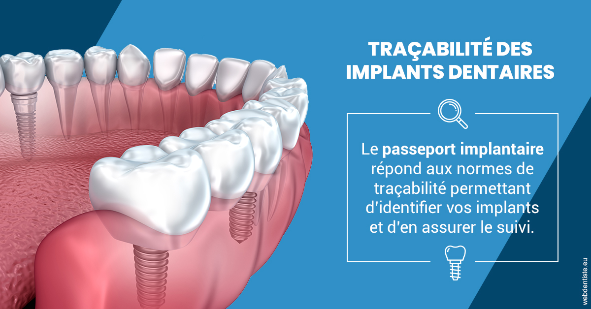 https://dr-zerbib-dan.chirurgiens-dentistes.fr/T2 2023 - Traçabilité des implants 1