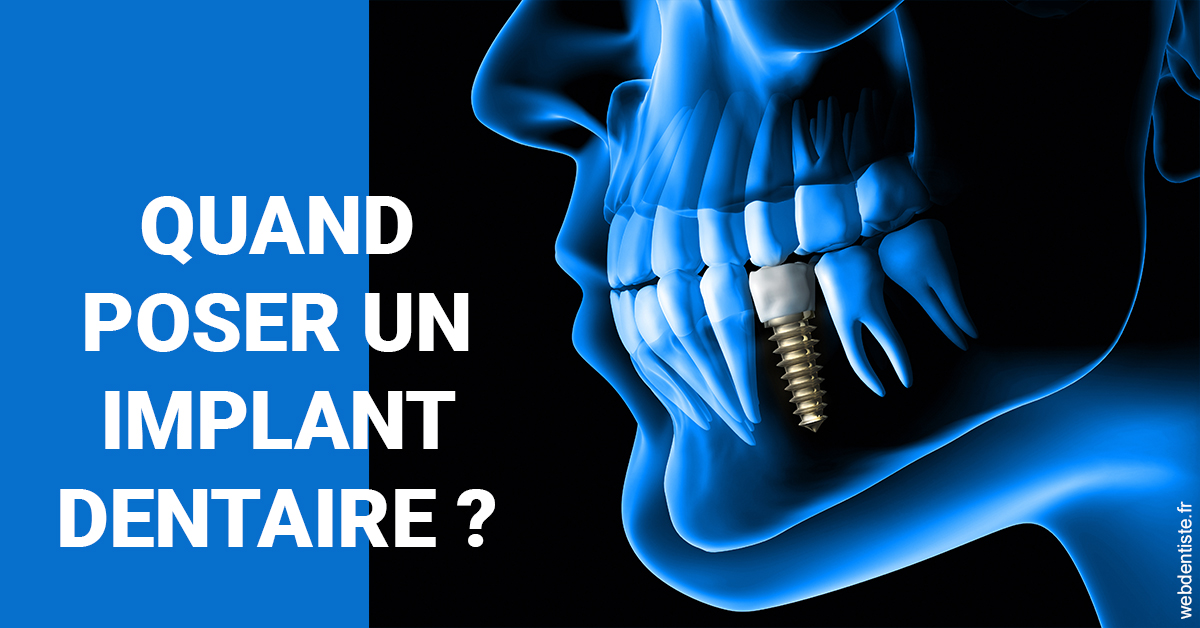 https://dr-zerbib-dan.chirurgiens-dentistes.fr/Les implants 1