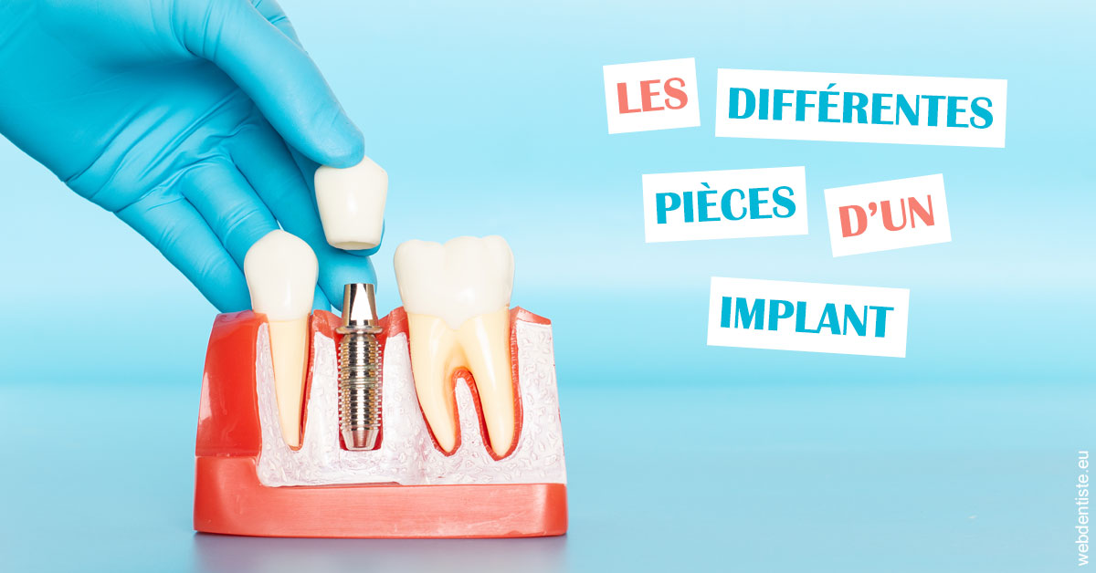 https://dr-zerbib-dan.chirurgiens-dentistes.fr/Les différentes pièces d’un implant 2