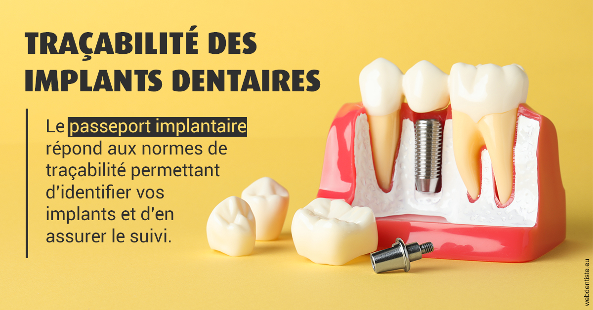 https://dr-zerbib-dan.chirurgiens-dentistes.fr/T2 2023 - Traçabilité des implants 2