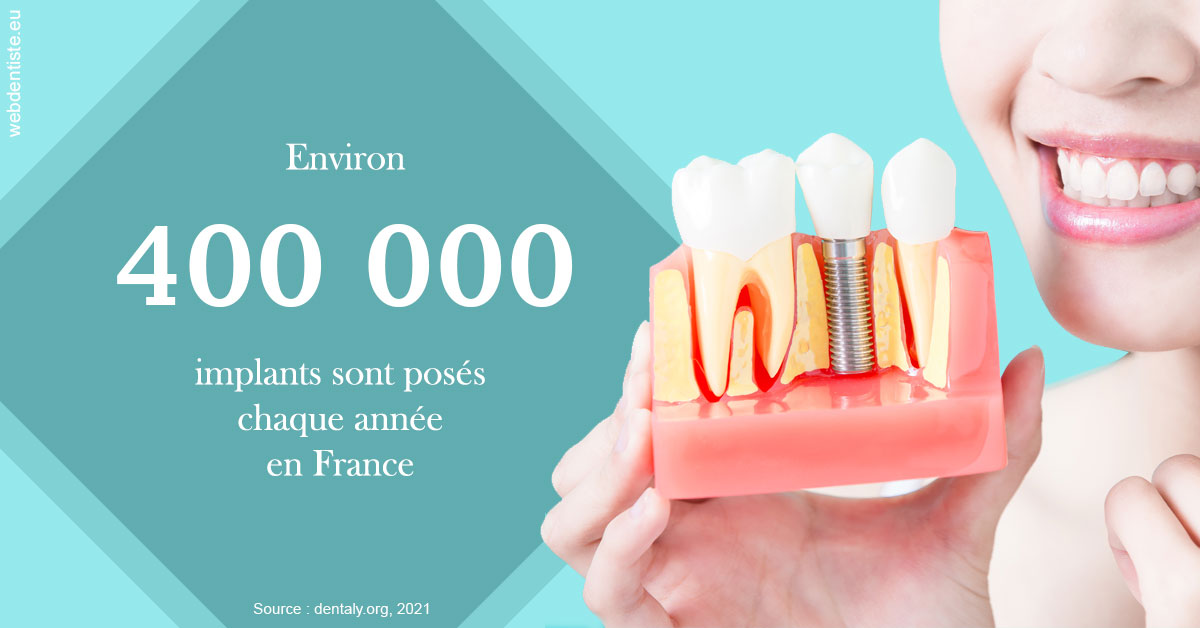 https://dr-zerbib-dan.chirurgiens-dentistes.fr/Pose d'implants en France 2
