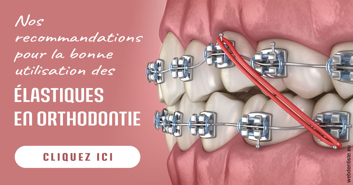https://dr-zerbib-dan.chirurgiens-dentistes.fr/Elastiques orthodontie 2